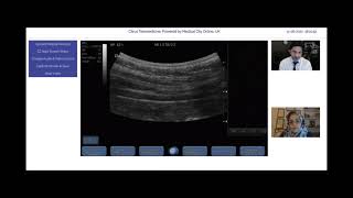 Tele Ultrasonography Liver Examination