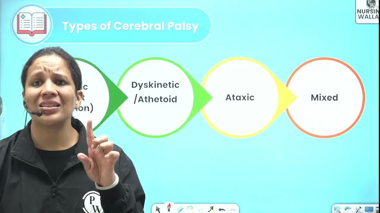 18 Nervous System 03 Cerebral Palsy and Febrile Seizures DPP Quiz Will