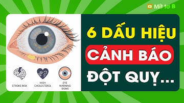 6 Dấu Hiệu Ở MẮT Cảnh Báo MỠ MÁU Cao Và Nguy Cơ Đột Quỵ.