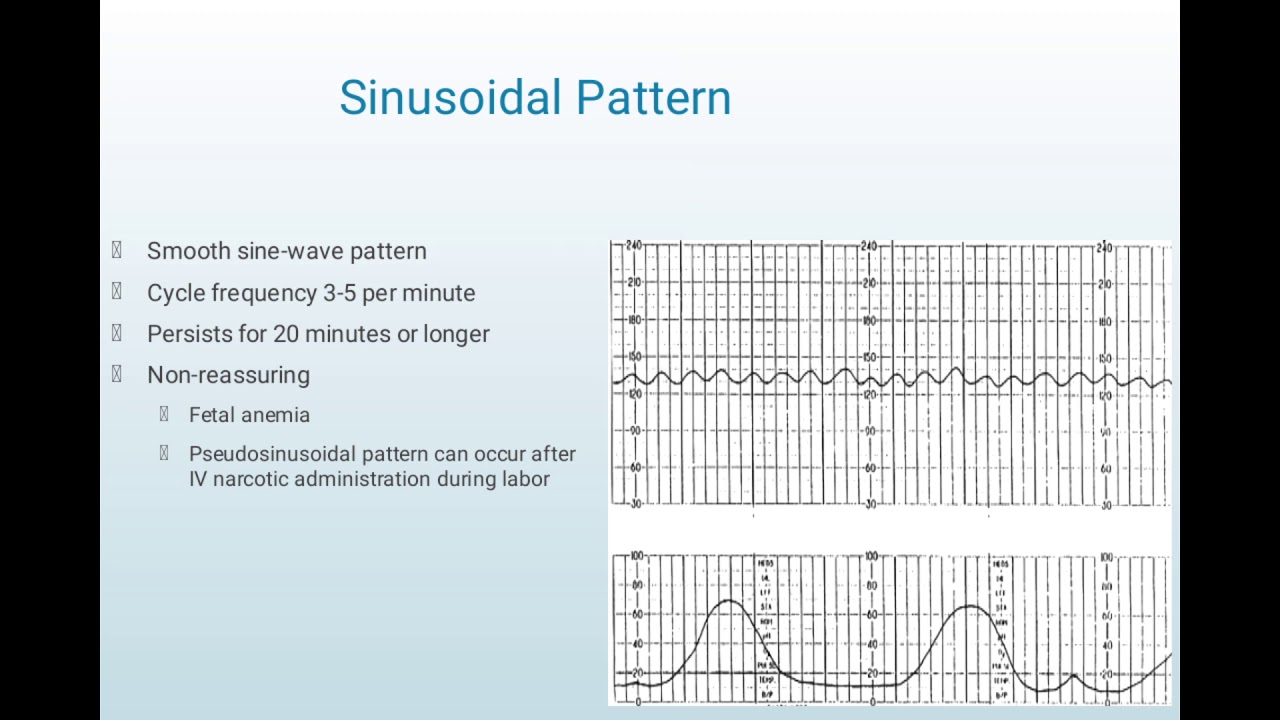 FETAL HEART TONES/SOUNDS (FETAL HEART RATE MONITORING AND ITS INTERVAL