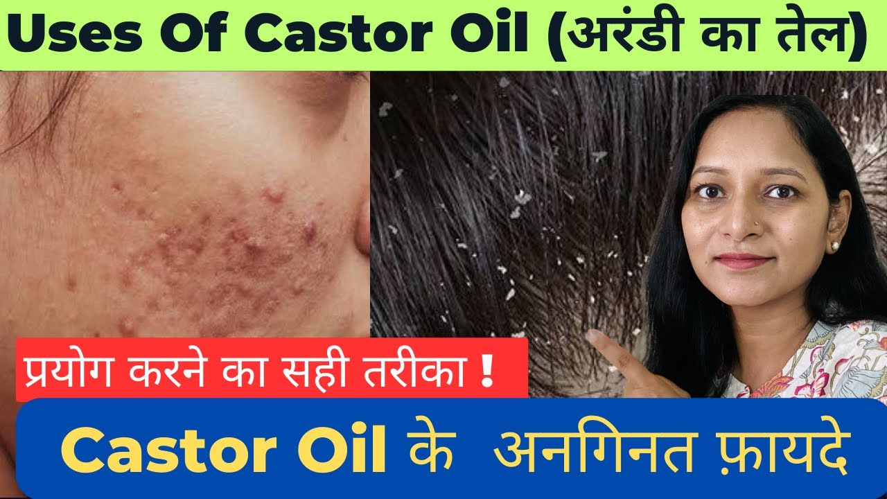 अरंडी के तेल के फायदे Castor oil benefits Castor oil for hair and skin castor oil ke fayde