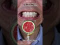 Satisfying Chewing ASMR #Compilation #ASMR #DoctorTristanPeh