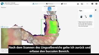 Scan-Protokoll - Elephant V3+ Scanner