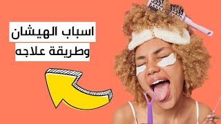 اسباب هيشان الشعر و ترطيبه و كيفية علاجه - فرح على