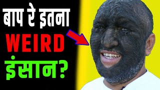 OMG! पूरी तरह बालों से ढका है इस शख्स का शरीर 😱 | World&#39;s Hairiest Man |