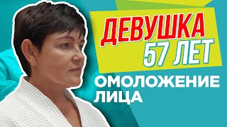 Фейслифтинг 👩🏻 Девушка 57 лет 🍓 Смас-пластика