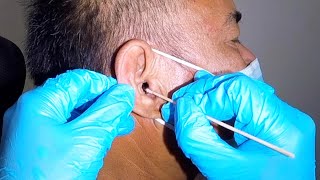 Elderly Man&#39;s Dark Earwax Removed &amp; Extracted