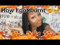 HOW I GOT BURNT IN THE KITCHEN🔥🔥🔥|| I WASNT EVEN COOKING!!!