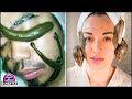 Top 6 Los Tratamientos de Belleza Más Terrorificos del Mundo