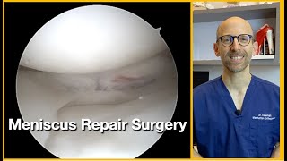 Meniscus repair surgical video (Bucket Handle Tear)