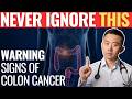 Warning Signs of Colon Cancer You Should Never Ignore