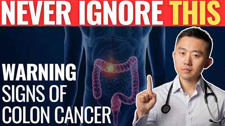 Warning Signs of Colon Cancer You Should Never Ignore