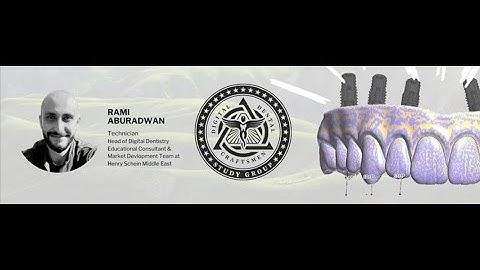 Denture for wax up abutment bridge workflow