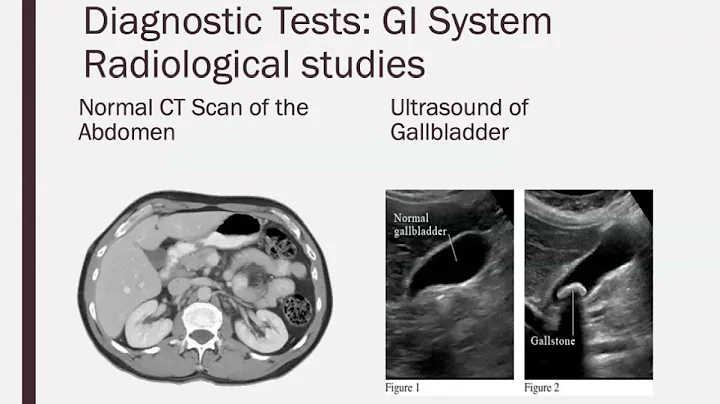 Diagnostic Tests and Procedures