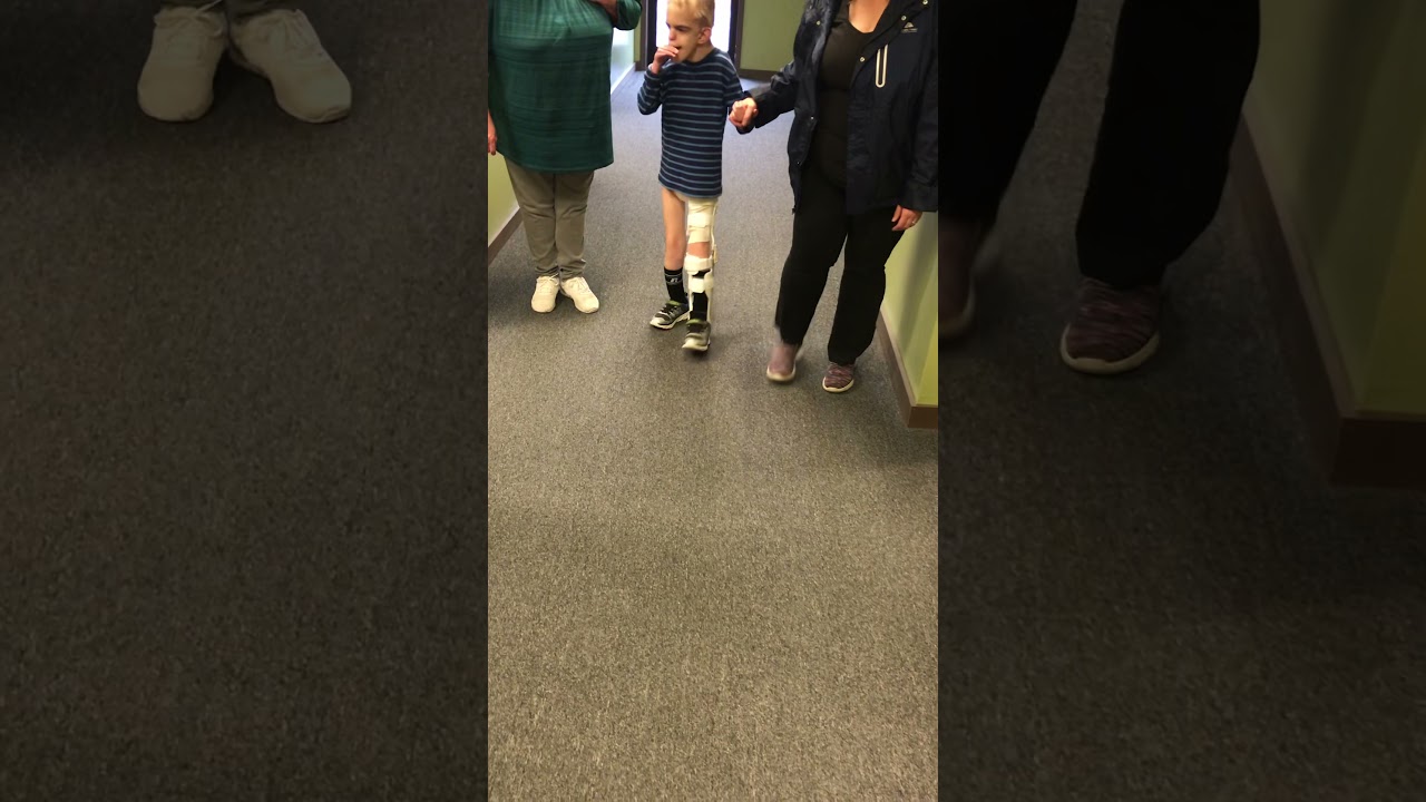 Kabuki Syndrome with brace