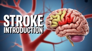 1. Introduction to Stroke (CVA) 🧠 USMLE Step 2 CK | Neurology Internal Medicine