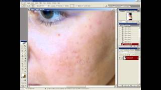 Уроки photoshop.9 урок.Исправление дефектов с помощью инструментов ретуши. Уроки photoshop.9 урок.Исправление дефектов с помощью инструментов ретуши.