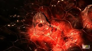 Catching a Horrifying Parasite That Liquifies Organs