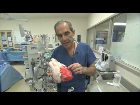 Heart Bypass Surgery Explained Part1