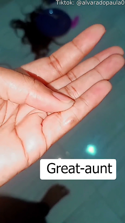 Family With Hereditary Extra Finger || ViralHog