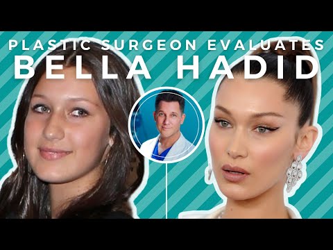 Video: Ano Ang Bella Hadid Bago Ang Plastic Surgery