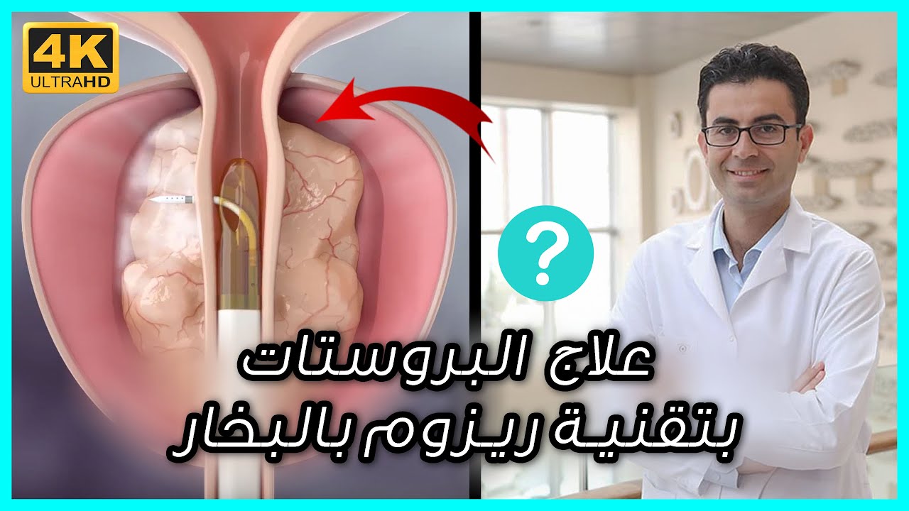 تقنية الريزوم لمعالجة تضخم البروستات الحميد بالبخار بدون جراحة  - مع البروفيسور محسن بالابان