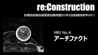 ○reConstruction MR No4