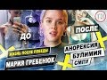 Как побороть АНОРЕКСИЮ / Жизнь Маши Гребенюк после победы в СМПУ