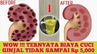 WOW !!! BIAYA CUCI GINJAL TERNYATA TIDAK SAMPAI Rp 5,000 | KHASIAT DAUN SELEDRI