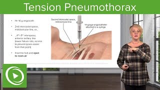 Tension Pneumothorax - Emergency Medicine | Lecturio