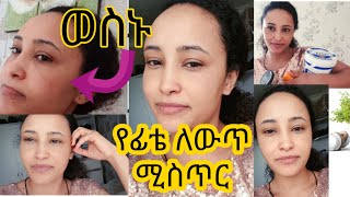 የፊቴን ማዲያት ምን አጠፋው ፊታችሁ ላይ ወቶ አልጠፋ ላላችሁ ነገር ሁሉ መፍትሄ