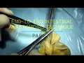 End-to-end intestinal anastomosis technique (part 2: anterior lip)