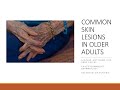 Common Skin Lesions in Older Adults