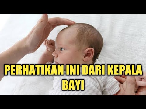 Video: Bila bila bayi harus menunduk?