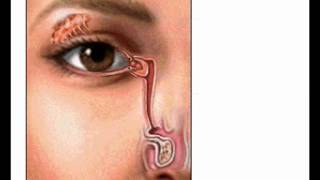 Blinking   Anatomy Video  MedlinePlus Medical Encyclopedia
