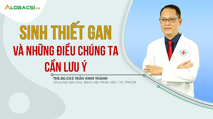 Sinh thiết gan có kết luận nhân quái là gì