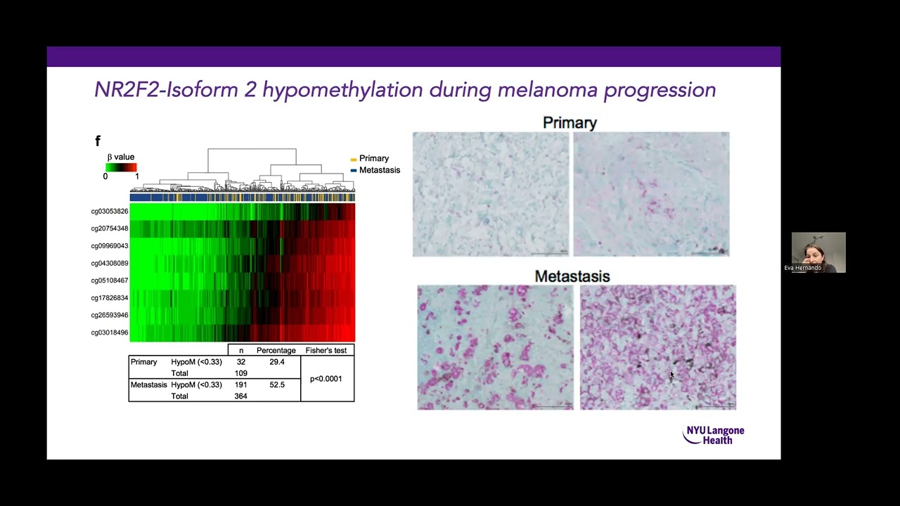 Yale Cancer Center Grand Rounds | March 14, 2023