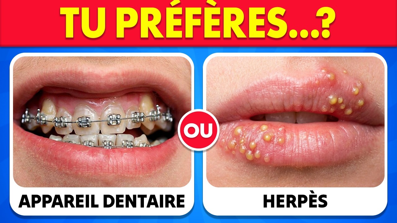 TU PRÉFÈRES...? 100 CHOIX IMPOSSIBLES NIVEAU EXTRÊME 🔥🧠