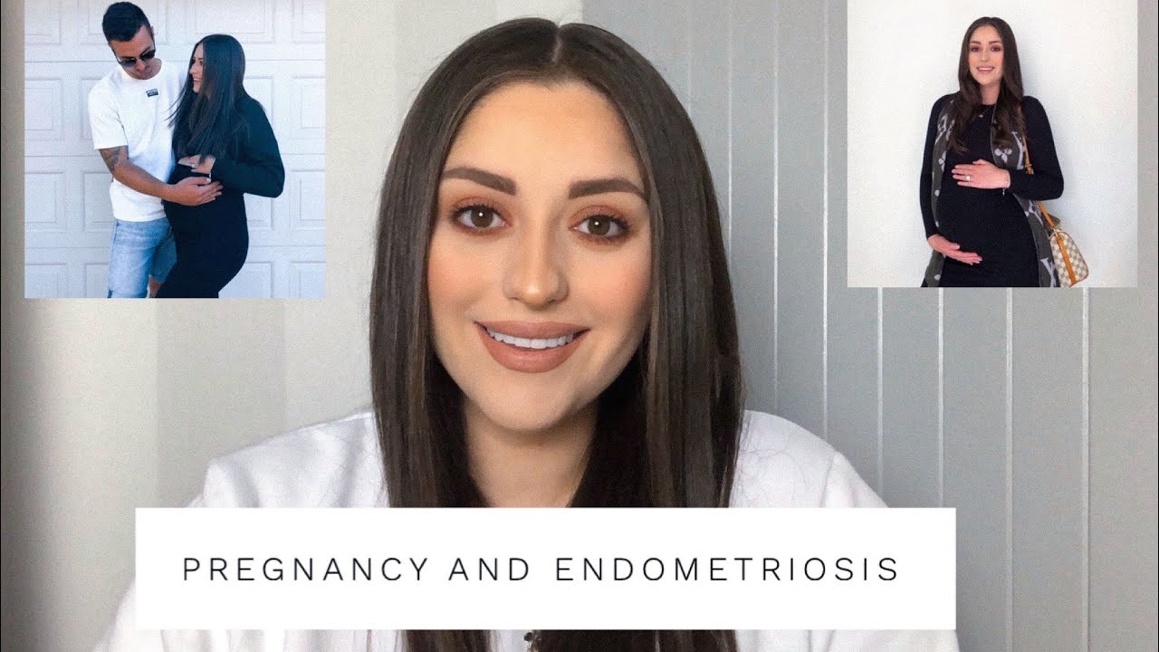 Pregnancy and Endometriosis Q&A