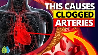1 Hidden Cause of Clogged Arteries