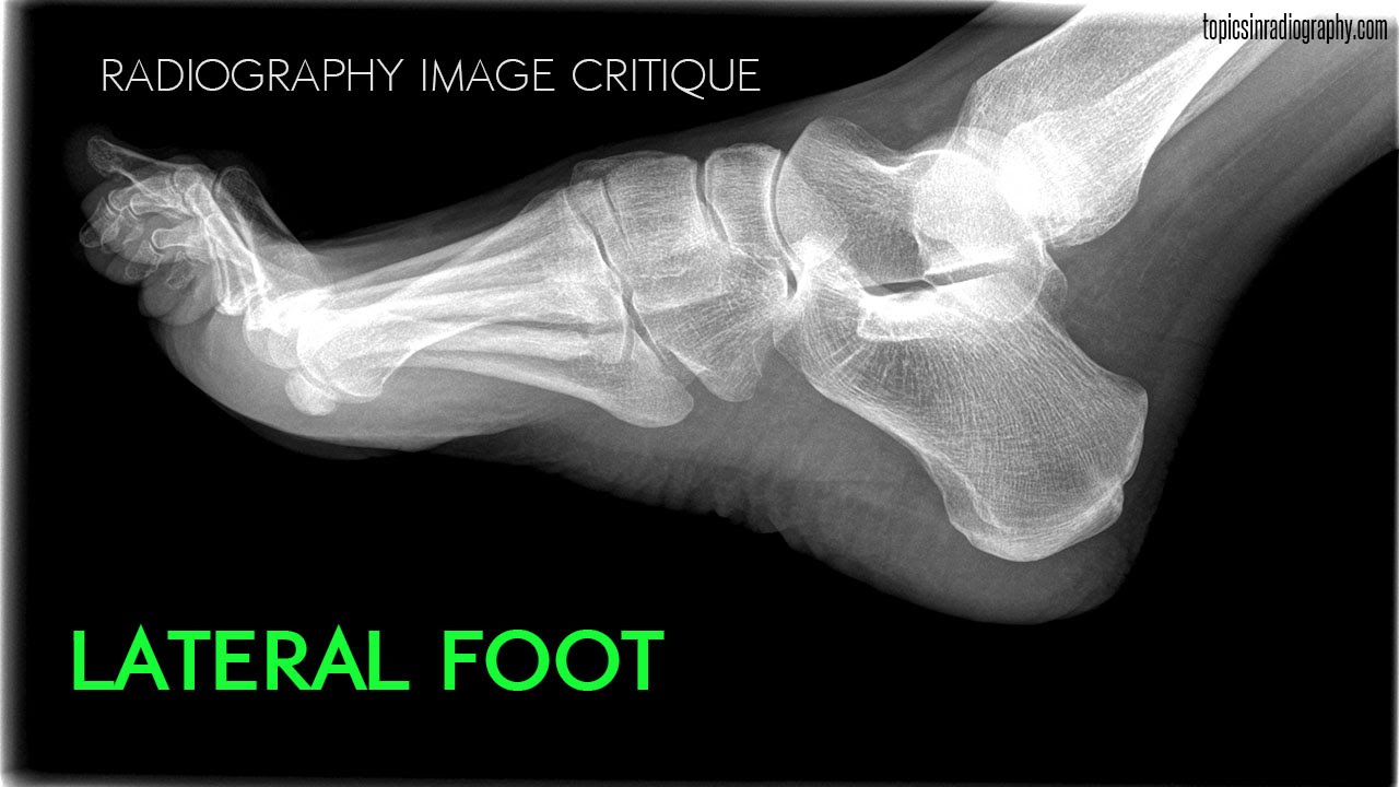 Topics in Radiography - YouTube