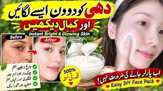 ​2 Days Challenge Yogurt Face Mask for Bright Soft |Clear & Glowing Skin screenshot 4
