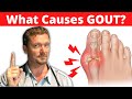 What causes gout meat doesnt cause gout 2024