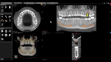 CS 3D Imaging   Film Composer Overview
