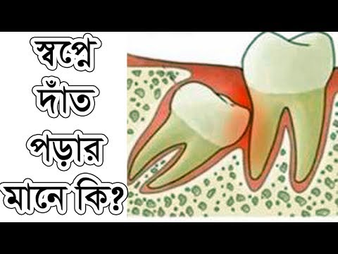 ভিডিও: পড়ে যাওয়ার অর্থ কী?