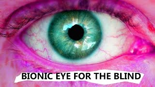 Bionic Eye for the Blind - REAL LIFE