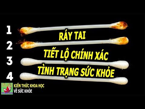 Video RÁY TAI TIẾT LỘ CHÍNH XÁC TÌNH TRẠNG SỨC KHỎE NHẤT... - youtube