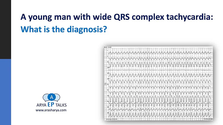 A young man with wide QRS complex tachycardia