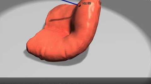 Capture and Modeling of Non-Linear Heterogeneous Soft Tissue
