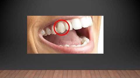 4TH STANDARD/ GENERAL SCIENCE/ CHAPTER 6/ OUR TONGUE AND TEETH /VIDEO 13